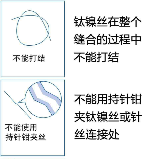 【兆恒机械】钛镍记忆合金组织吻合器使用注意事项